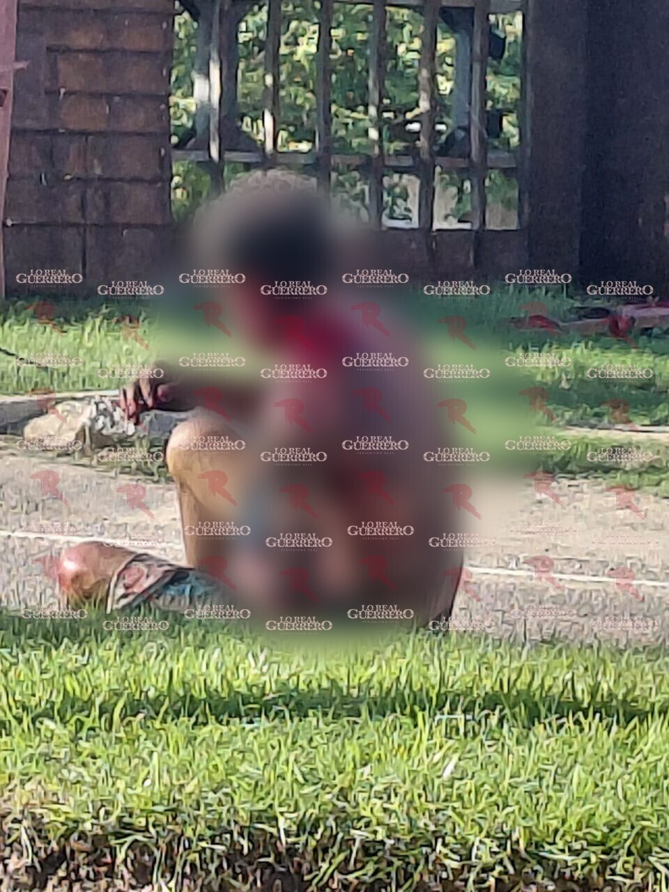 Atacan a machetazos a un hombre en la Bonfil; le desprenden una oreja